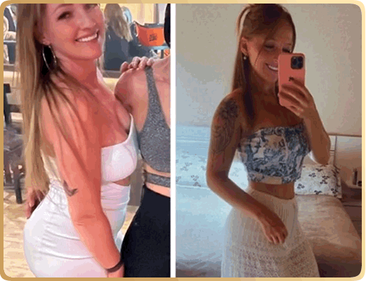 Nutricionista Brenda Natascha - Antes e Depois