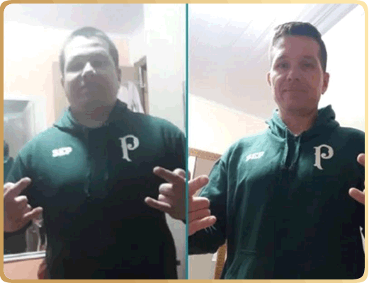 Nutricionista Brenda Natascha - Antes e Depois