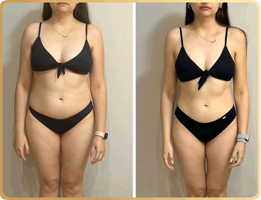 Nutricionista Brenda Natascha - Antes e Depois