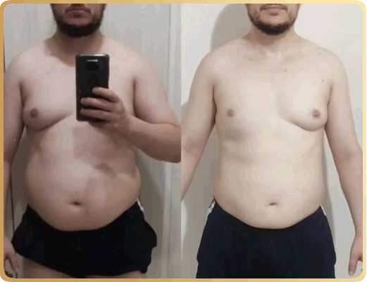 Nutricionista Brenda Natascha - Antes e Depois