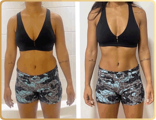 Nutricionista Brenda Natascha - Antes e Depois