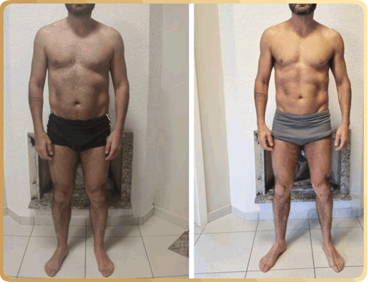 Nutricionista Brenda Natascha - Antes e Depois