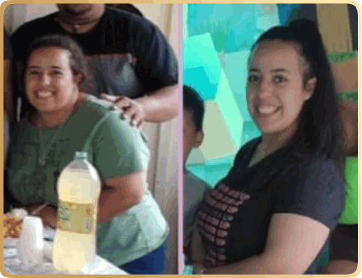 Nutricionista Brenda Natascha - Antes e Depois